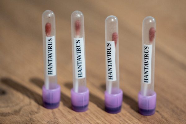 Pacientă franceză în stare critică cu hantavirus, tratată la Paris cu plămân artificial